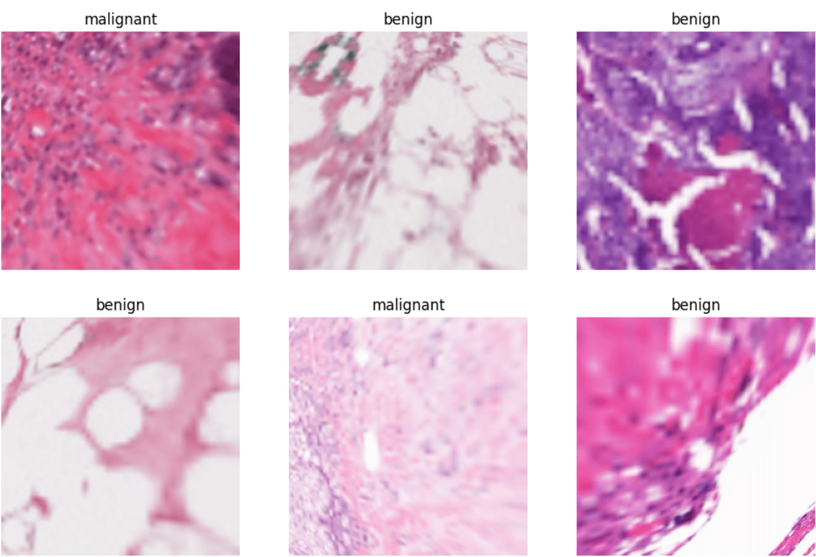 Cancer Cell Identification